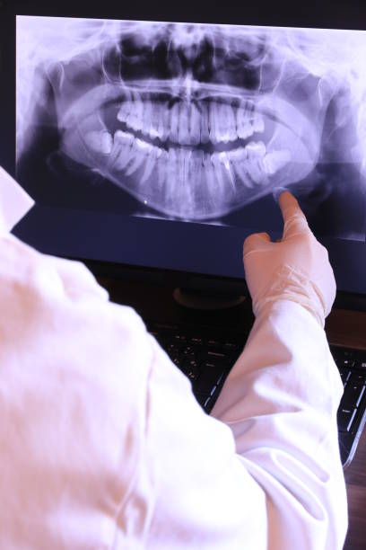 Best Emergency Treatment for Dental Infections or Abscesses in Bridgeport, PA